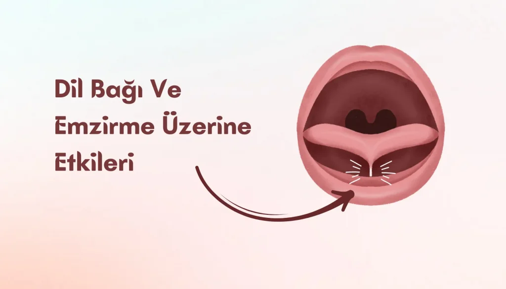 Bebektivite | Ankiloglossi Nedir? Bebeklerde Emzirme Üzerindeki Etkileri